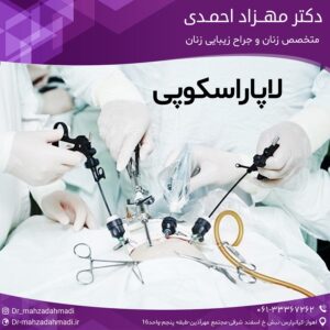 لاپاراسکوپی
