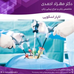لاپاراسکوپی