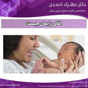 القای زایمان چیست؟ دکتر مهزاد احمدی