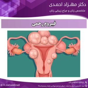 فیبروم رحمی دکتر مهزاد احمدی