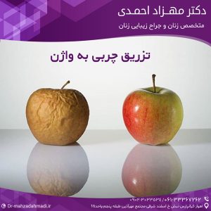تزریق چربی به واژن