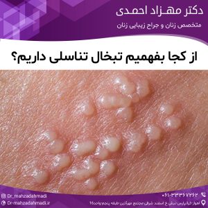 از کجا بفهمیم تبخال تناسلی داریم؟