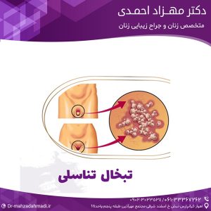 از کجا بفهمیم تبخال تناسلی داریم؟