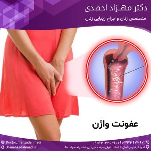 عفونت واژن