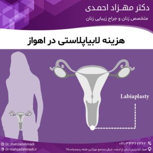 هزینه لابیاپلاستی در اهواز