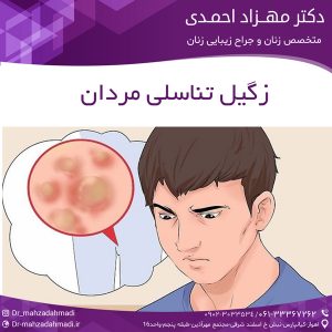 زگیل تناسلی مردان
