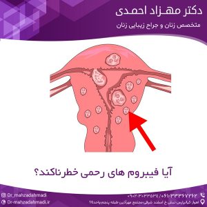 آیا فیبروم های رحمی خطرناکند؟