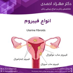 انواع فیبروم