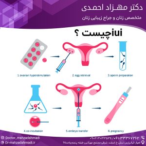 iui چیست ؟