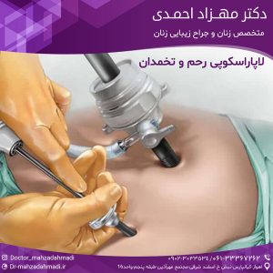 لاپارسکوپی رحم و تخمدان