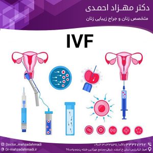 IVF چیست؟